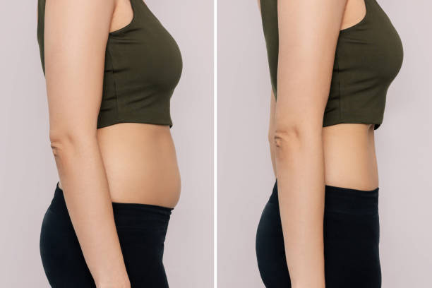 a woman with belly with excess fat and toned slim stomach with abs before and after losing